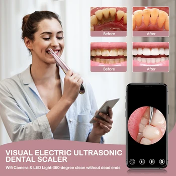 Ультразвуковой Стоматологический Скалер Для удаления зубного камня, Машина для мытья рта, Отбеливание зубов с камерой высокой четкости, Зубной камень, Чистка зубов
